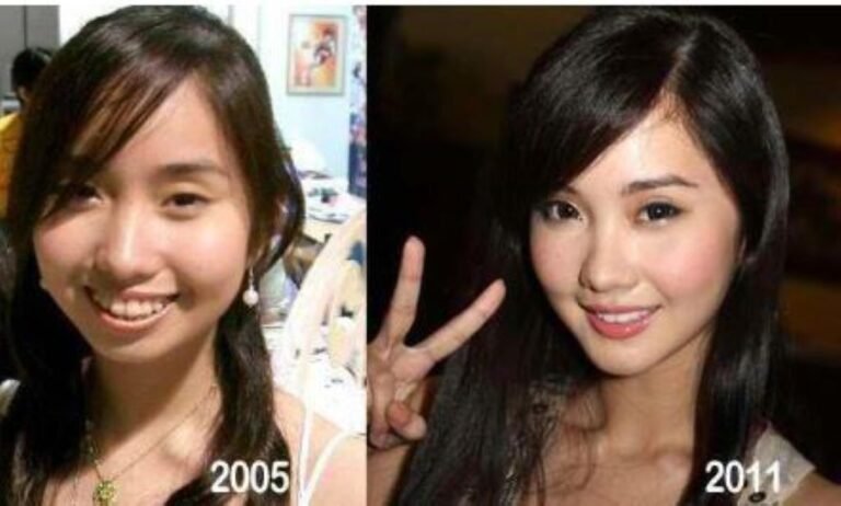 Alodia Gosiengfiao Before Cosmetic Surgery How Did She Look