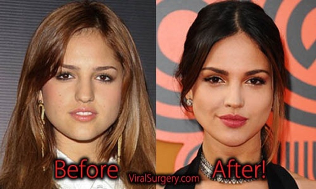 Eiza Gonzalez Nose Job