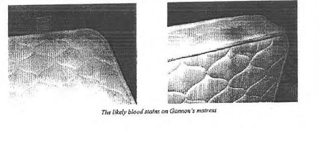 Gannon Stauch Autopsy Report