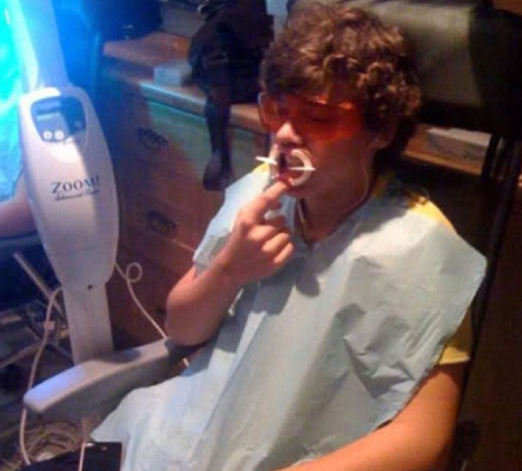 Harry Styles Teeth Transplant