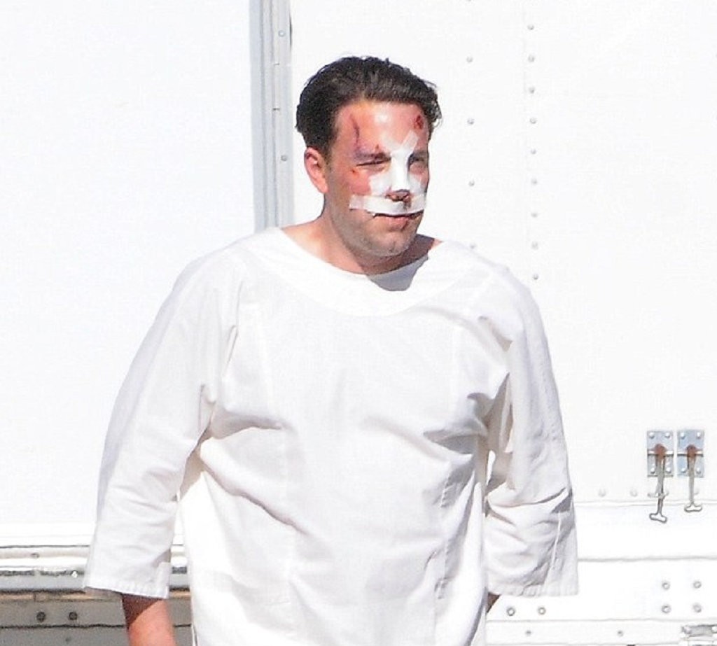 Ben Affleck Nose Job