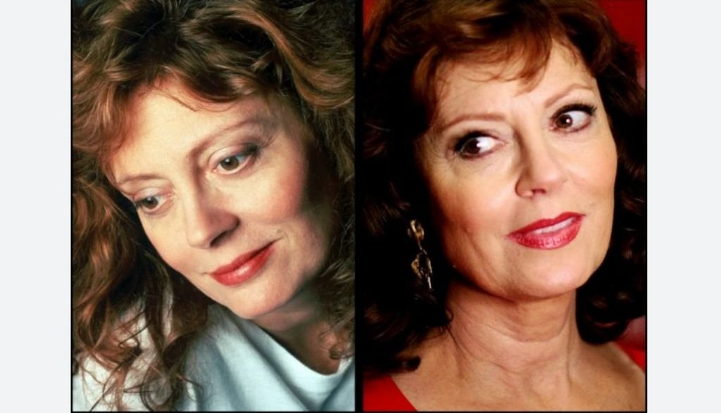 Susan Sarandon Face Lift