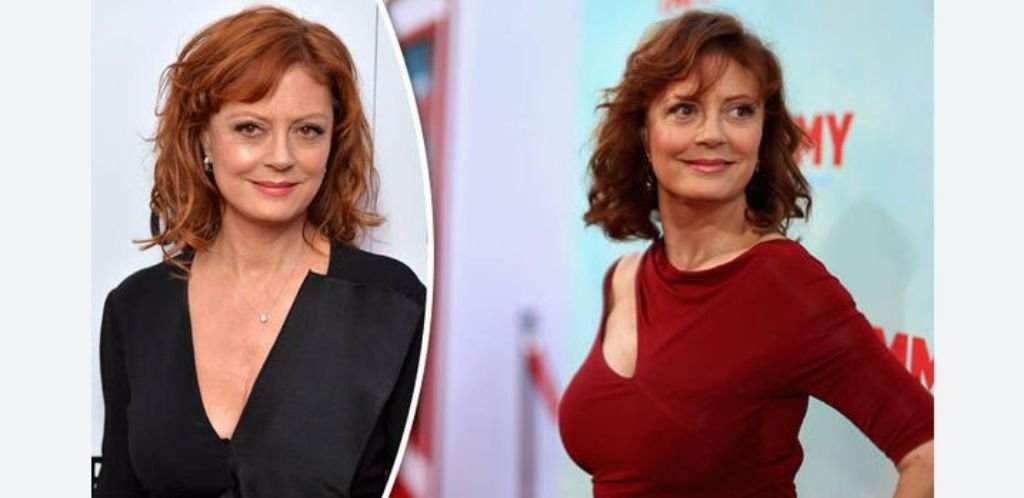 Susan Sarandon Face Lift