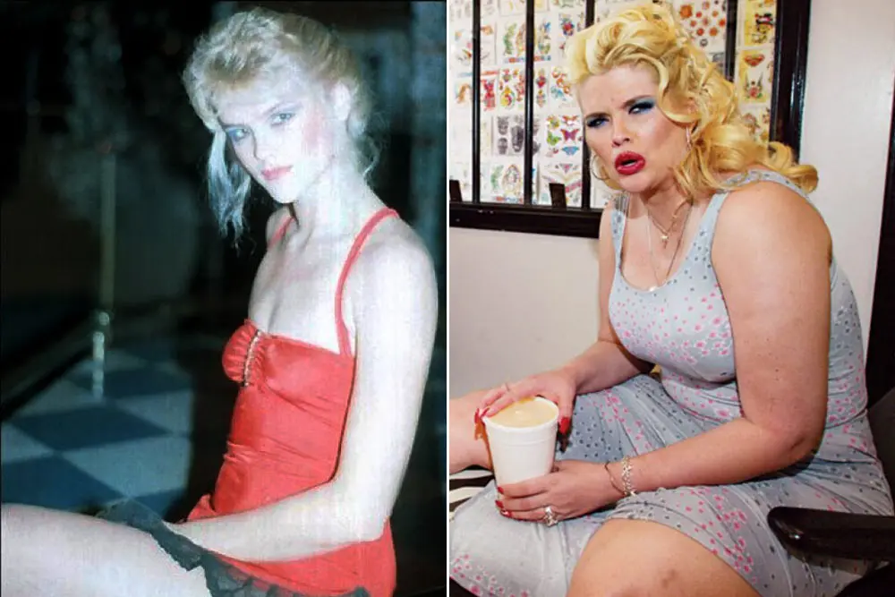 Anna Nicole Smith Plastic Surgery