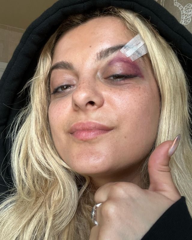 Bebe Rexha DID