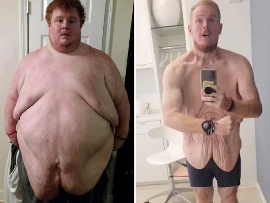 Casey King weight loss