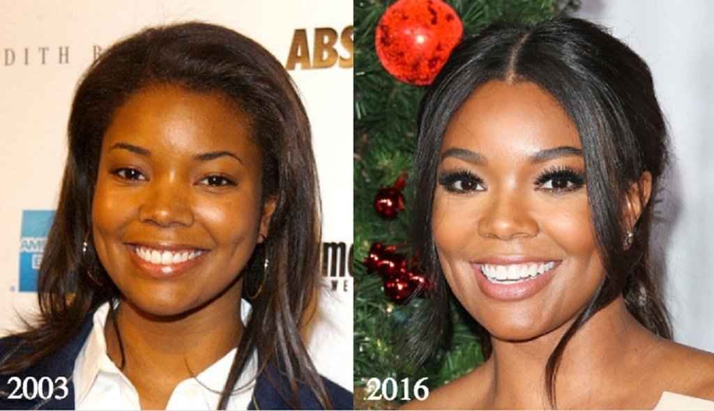 Gabrielle Union Face Lift