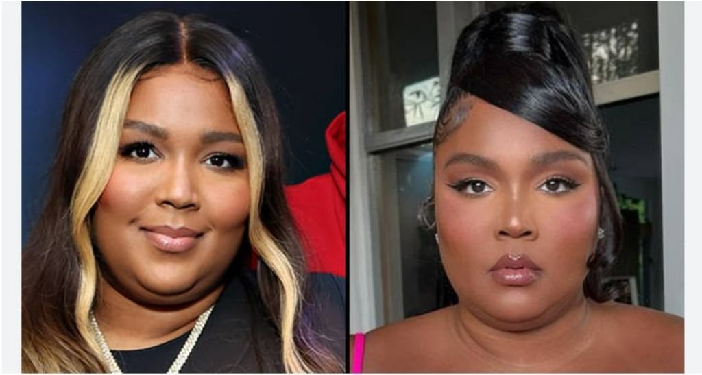 Lizzo Plastic Surgery