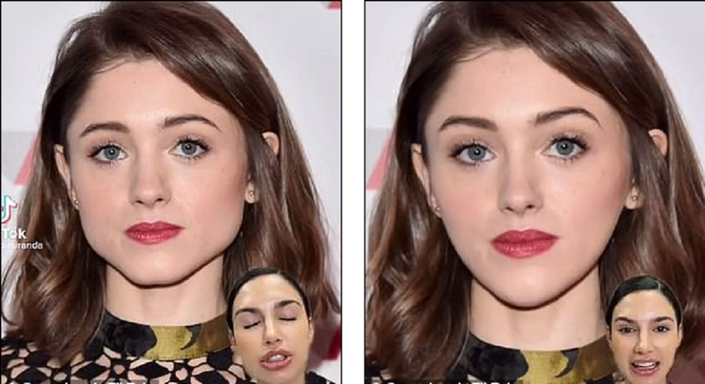 Natalia Dyer Plastic Surgery