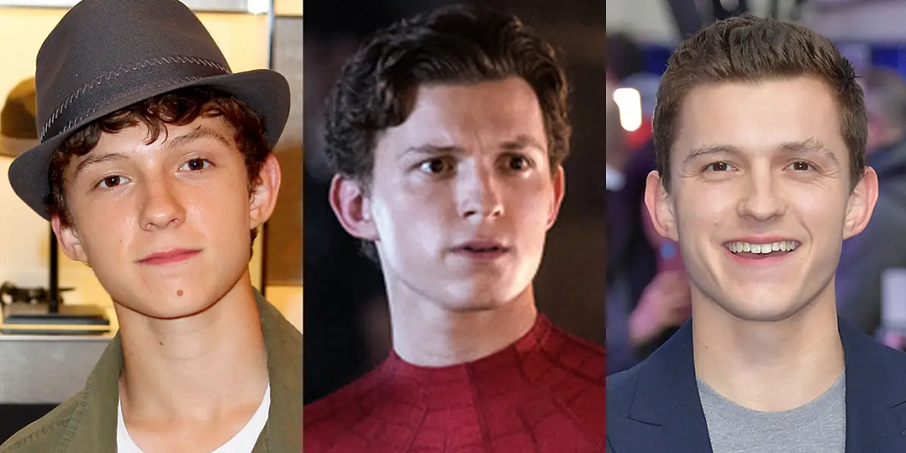 Tom Holland botox