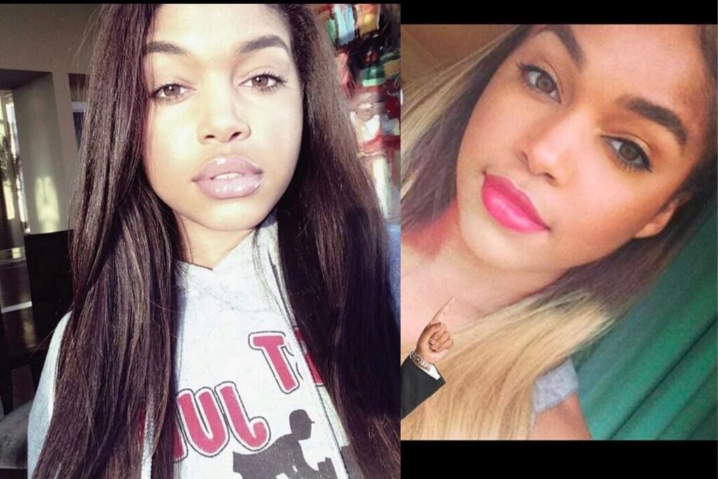 Lori Harvey before surgery