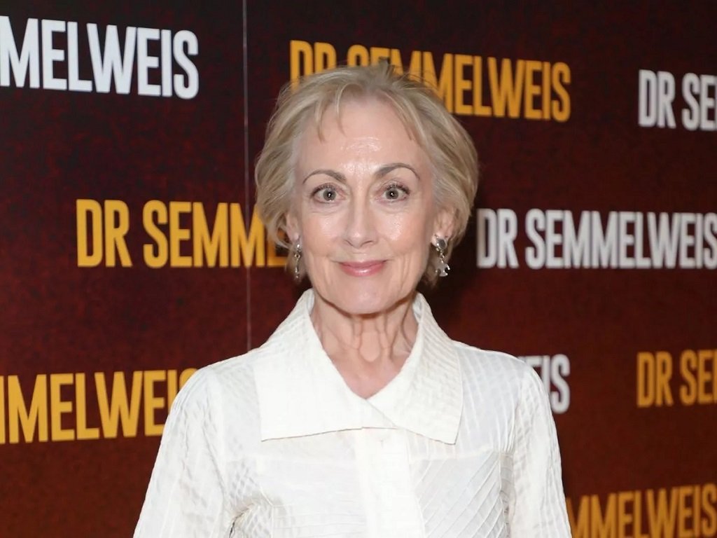 Paula Wilcox plastic surgery