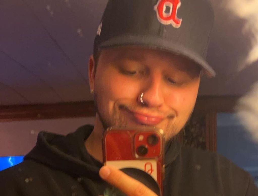 Cheeto Head Face Reveal