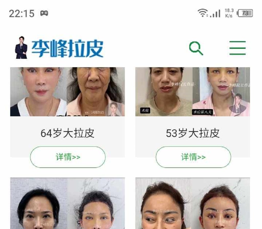 Dr Li Feng plastic surgery