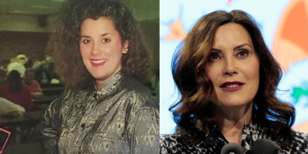 Gretchen Whitmer Plastic Surgery