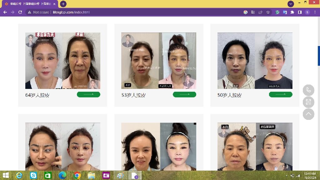 Dr Li Feng plastic surgery