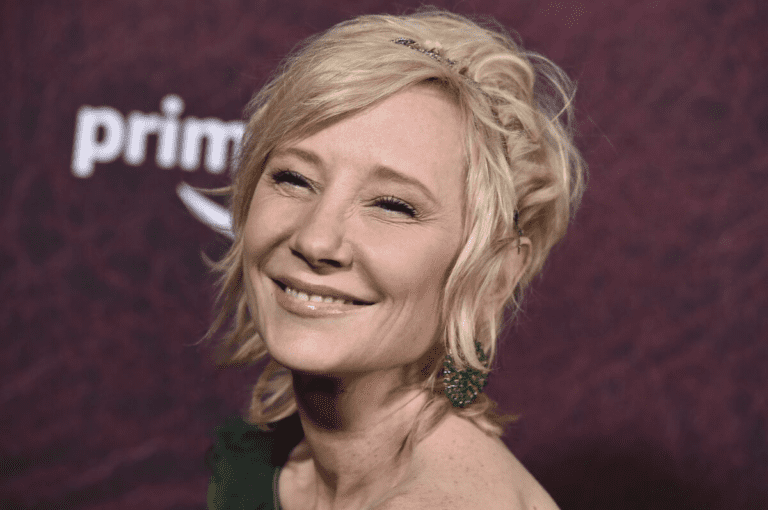 Anne Heche Autopsy Report: No Evidence Of Drugs, Died Of Inhalation And Thermal Injuries