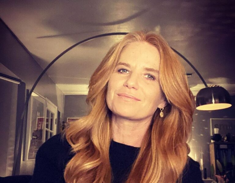 Did Patsy Palmer Get Her Nose Done? Plastic Surgery, Kids And Family