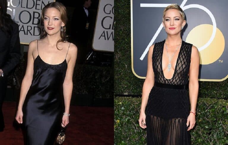 Did Kate Hudson Get Her Nose Done? Plastic Surgery Before And After
