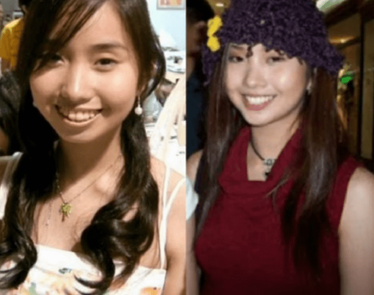 Alodia Gosiengfiao Plastic Surgery: Before And After Photos