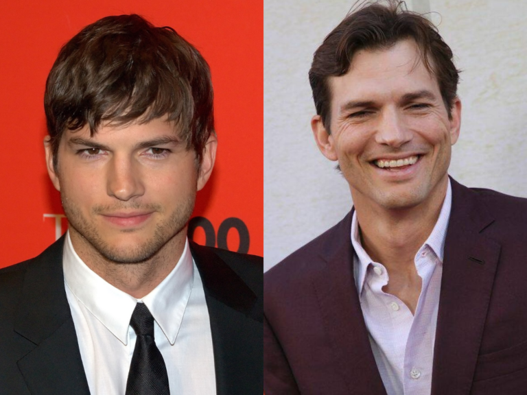 Ashton Kutcher Botox Then And Now: Did He Get A Nose Job?