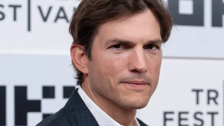 Ashton Kutcher Botox Then And Now- Did He Get A Nose Job?