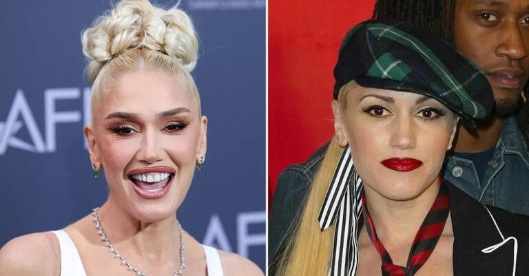 Gwen Stefani Face Lift: Plastic Surgery Before And After