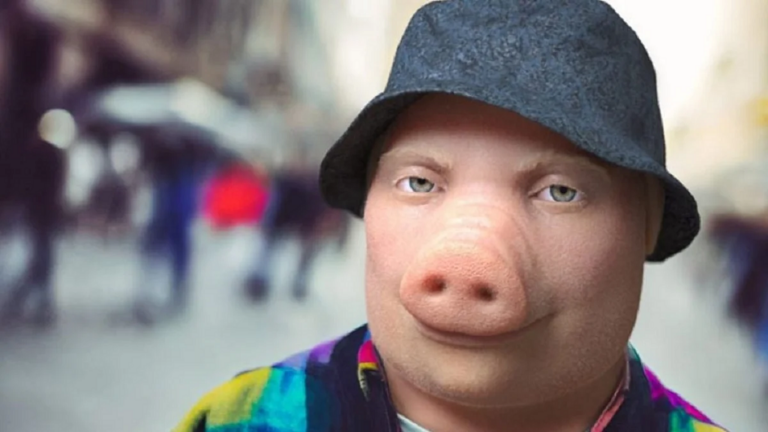 John Pork Pig Face: Did He Get Surgery Or Born With It?