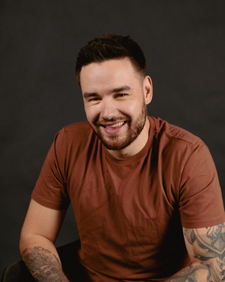 Are Liam Payne Botox Rumors True? Did He Get A Facelift Surgery?