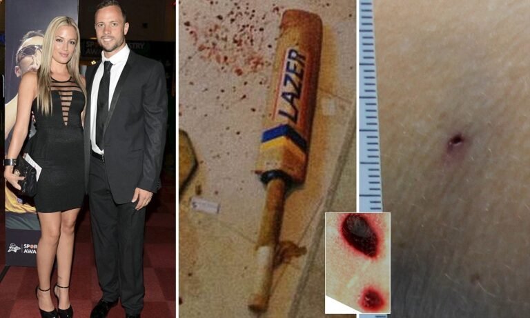 Reeva Steenkamp Autopsy Photos: Murder Case Update- Who Killed Oscar Pistorius Girlfriend?