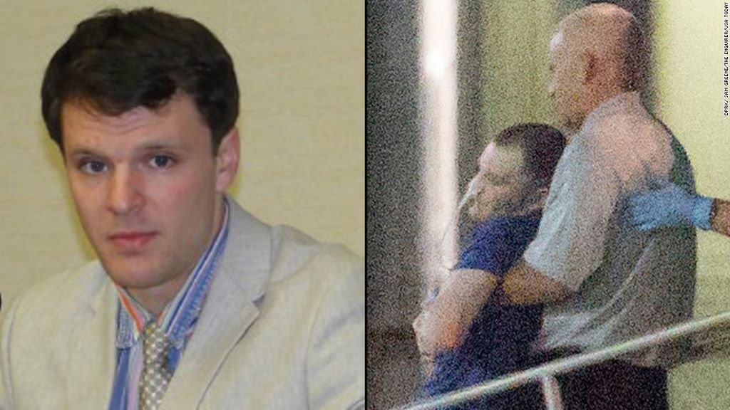 Otto Warmbier Teeth Before And After