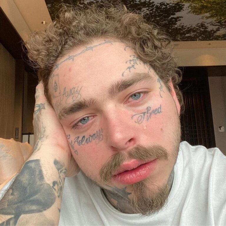 Post Malone Plastic Surgery – Did He Get His Nose Done? Before And After Photos