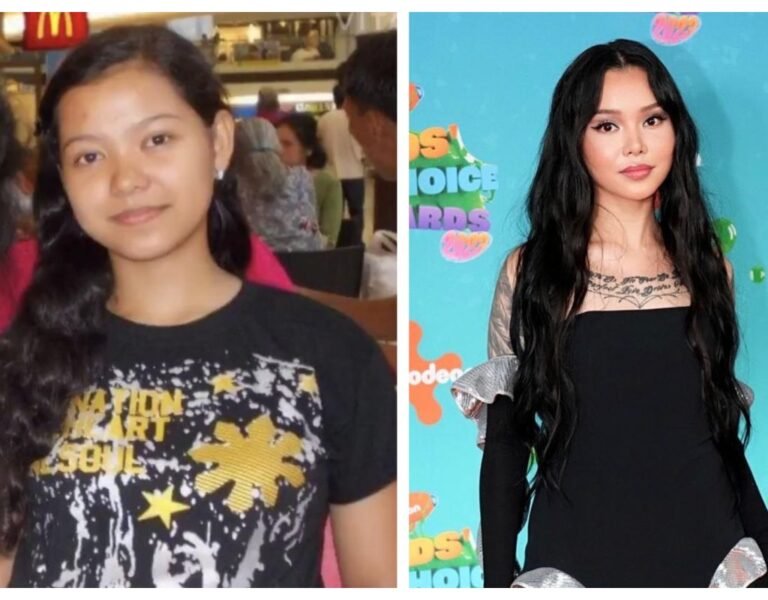 Bella Poarch Plastic Surgery Did She Get Her Nose Done?