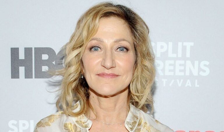 Edie Falco Weight Gain – Before And After Photos