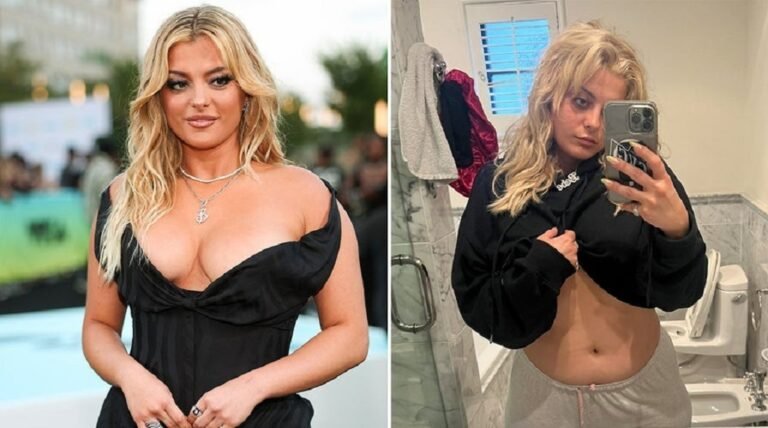 Bebe Rexha Before And After: Did She Get Her Nose Done?