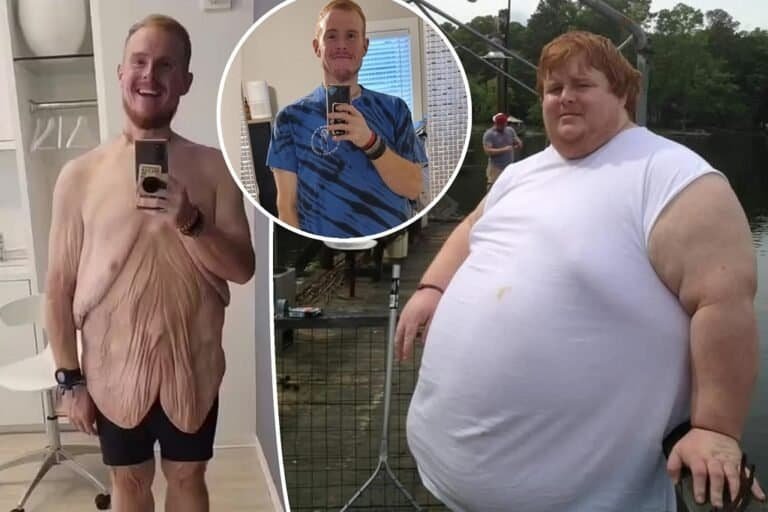 Casey King Weight Loss Transformation: Before And After Photos