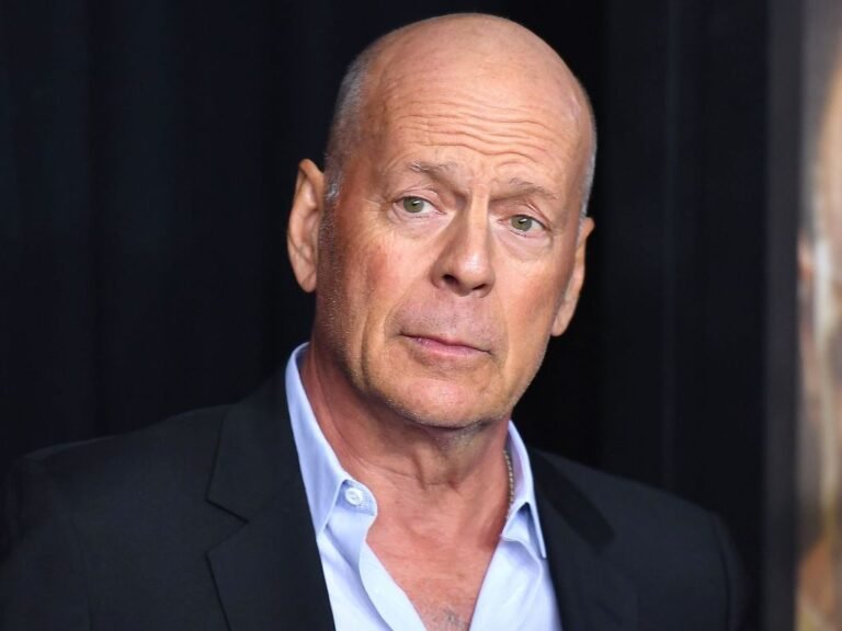 Did Bruce Willis Alopecia Caused Hair Loss? Does He Wear A Wig?