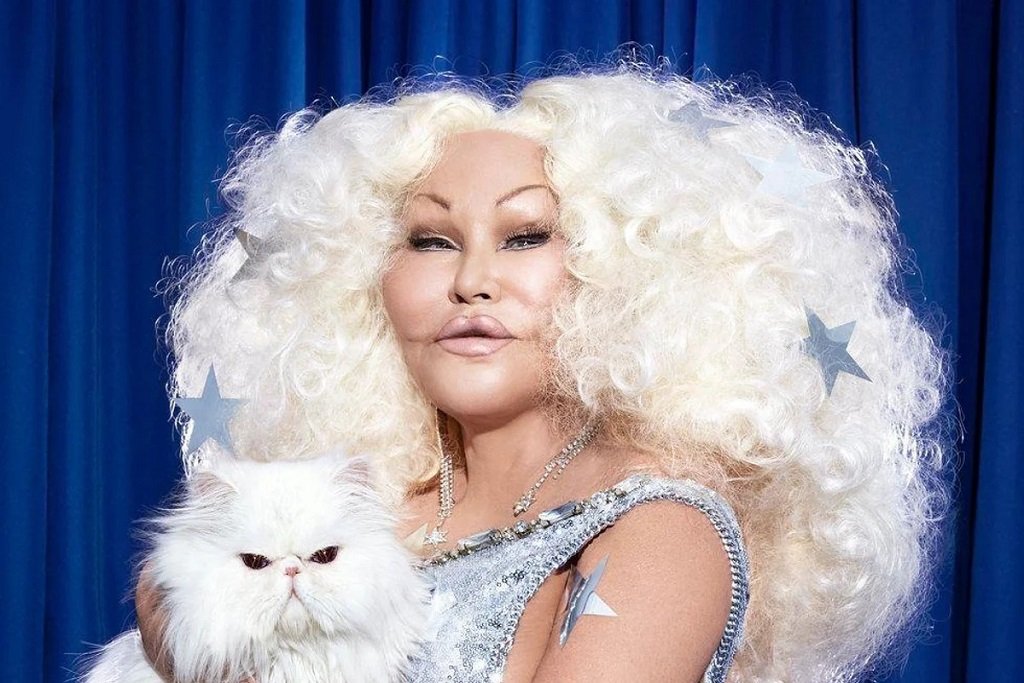 Jocelyn Wildenstein Before Surgery