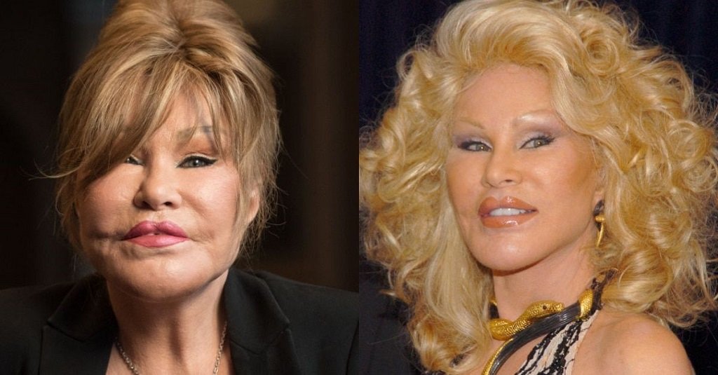 Unveiling The Transformation Jocelyn Wildenstein Before The Fame