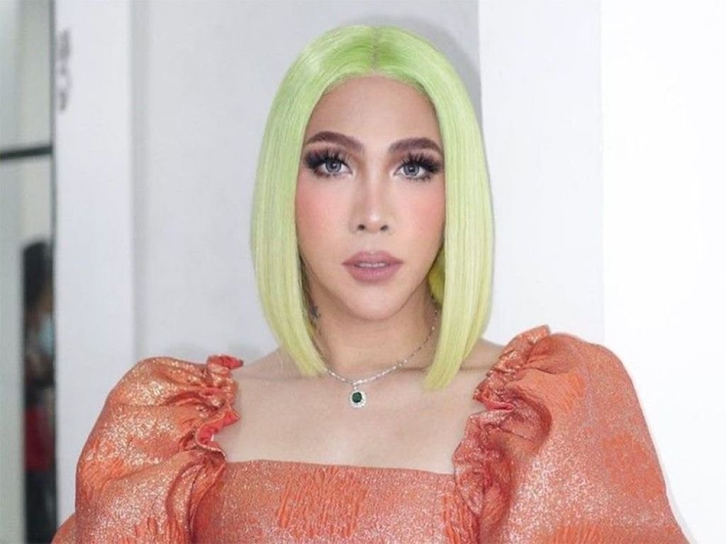 Vice Ganda Accident