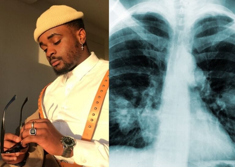 What Happened To Garry Mapanzure? Disease And Lung Cancer Update 2023