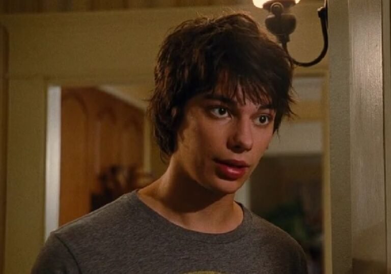 Devon Bostick Accident Led To Face Burn: Injury Update