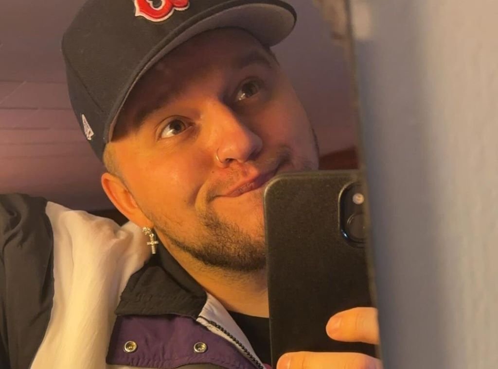 Cheeto Head Face Reveal